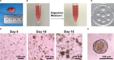 Establishment of papillary thyroid cancer organoid lines from clinical specimens